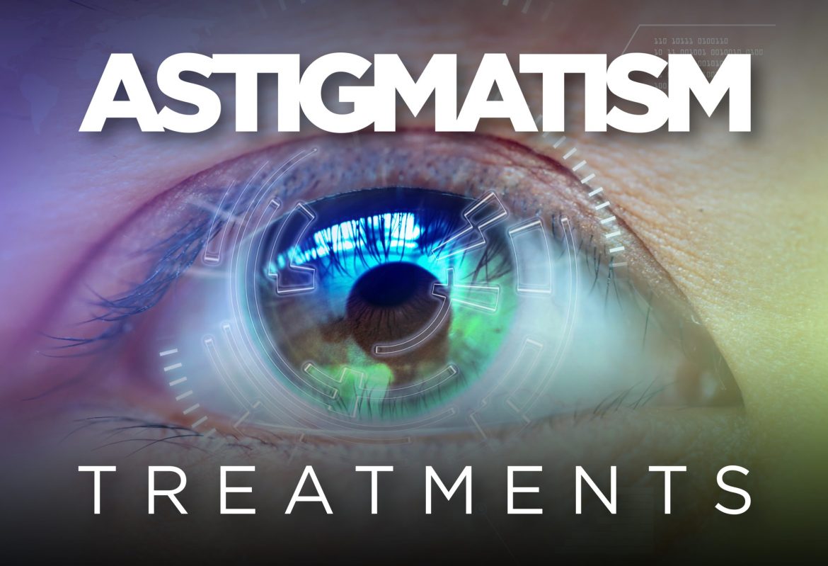 astigmatism treatments