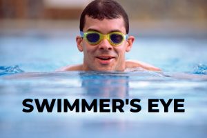 Swimmer's eye