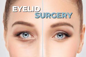 eyelid surgery